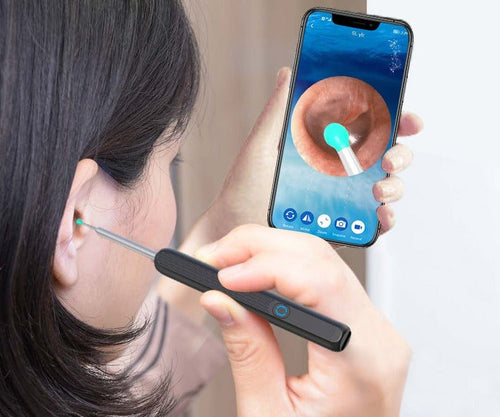 Otocam™ Ear Cleaner With Camera